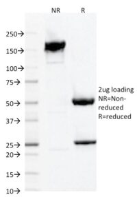 Data from SDS-PAGE analysis of Anti-AIF1 antibody (Clone AIF1/1909). Reducing lane (R) shows heavy and light chain fragments. NR lane shows intact antibody with expected MW of approximately 150 kDa. The data are consistent with a high purity, intact mAb.